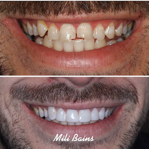 Nuvo Dental + Implant Centre - Dentist