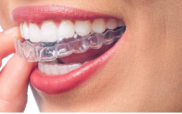 lek.stom. Katarzyna Mazur specjalista Ortodonta Estedent Clinic Ortodoncja Niewidoczna Invisalign, Author: dr Katarzyna Mazur Ortodonta Kielce "Estedent Clinic" Ortodoncja Niewidoczna Invisalign