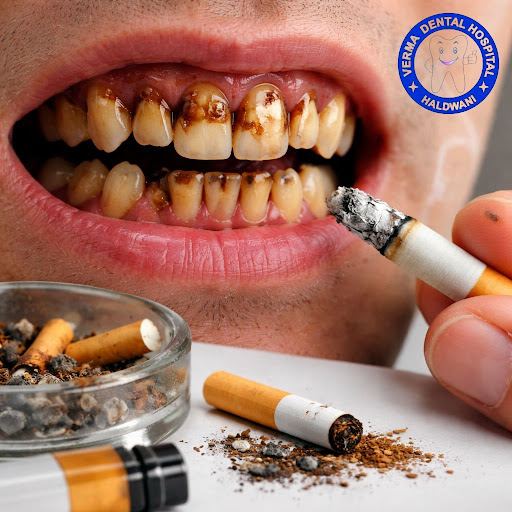 Smoking doesn’t just affect your lungs – it silently damages your gums, teeth and smile. At VERMA…