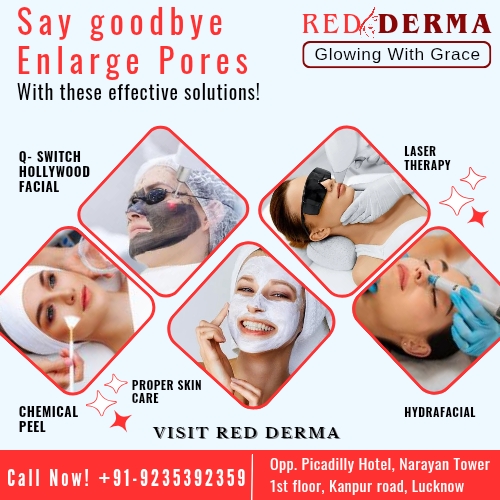 Red Derma Clinic available spacial offer this Winter  post image