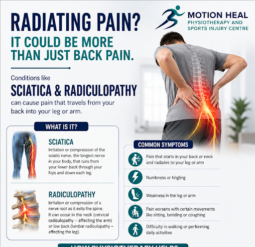 Sciatica and radiculopathy pain post image