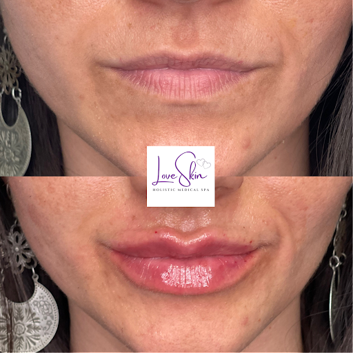 Love Skin Holistic Medical Spa