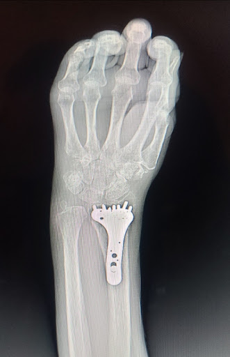 Advanced Center for Orthopedics and Plastic Surgery