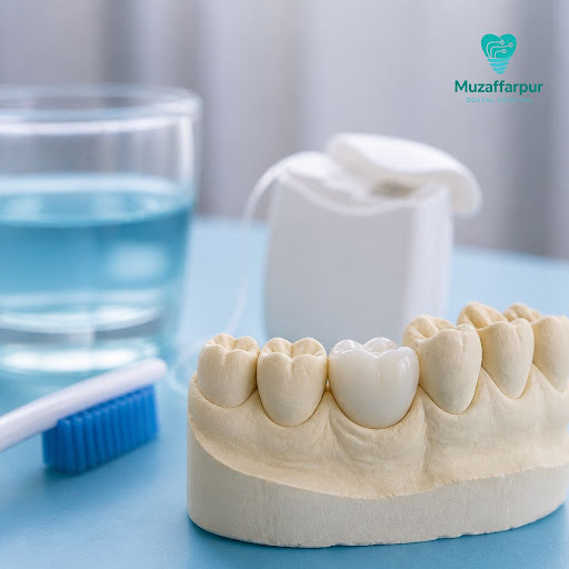 Dental crowns are a long-term investment in your smile and oral health. At Muzaffarpur dental hos… post image