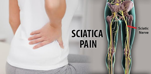 Sciatica happens when irritation, inflammation, pinching or compression affect one or more nerves… post image