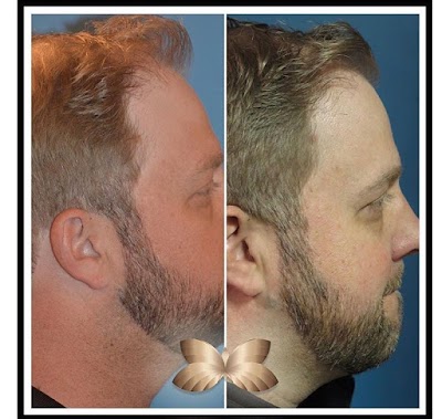 UFP Hair Restoration