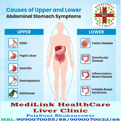 #endoscopycenteratpalasuni post image