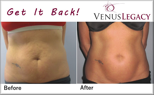 Elements Laser Spa - Visual