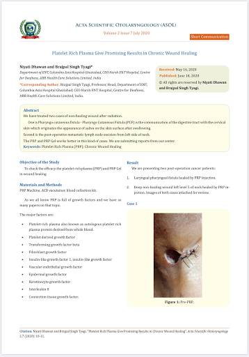 Published Article : Wound Healing With PRP !