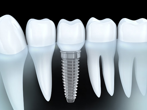 Dental Service - Thumbnail