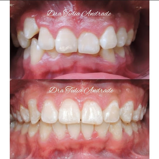 Andradent Dra Tulia Andrade R. Ortodoncista Plaza Cubos Local 19 - Thumbnail