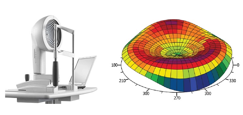 サトウ眼科（ICL・LASIK・両眼同時白内障手術）