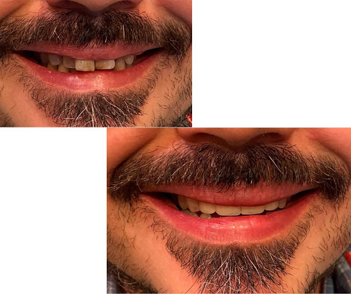 Hanna Dental Group Gallery - United States