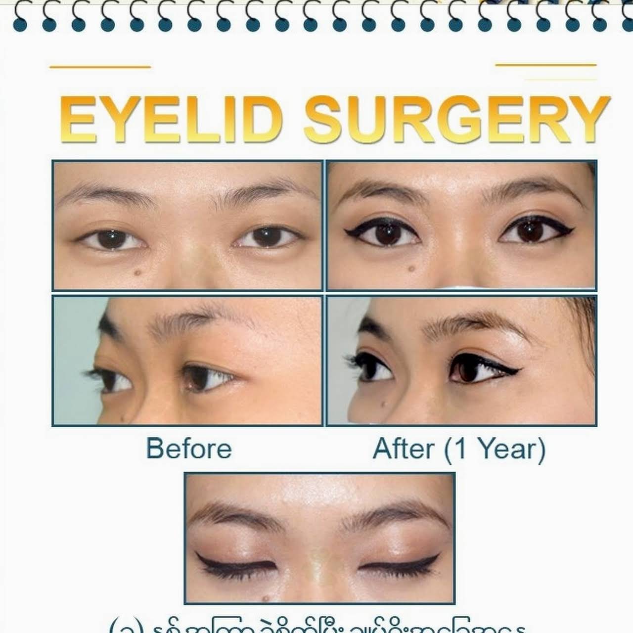 Gangnam Medical Beauty Centre - Plastic Surgery Clinic in ရန်ကုန်