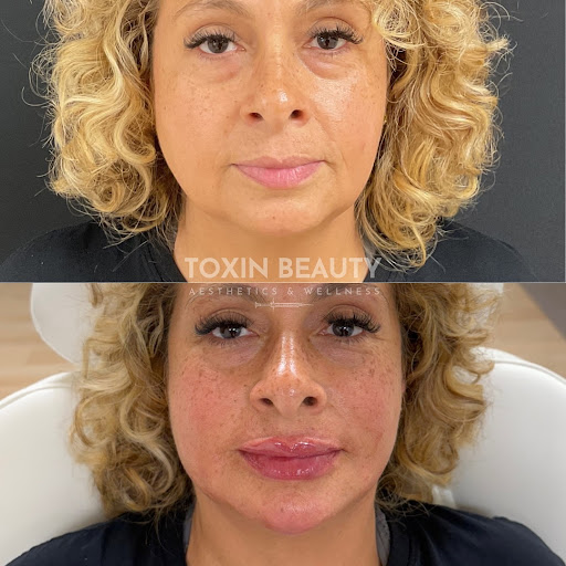 Toxin Beauty Aesthetics and Wellness