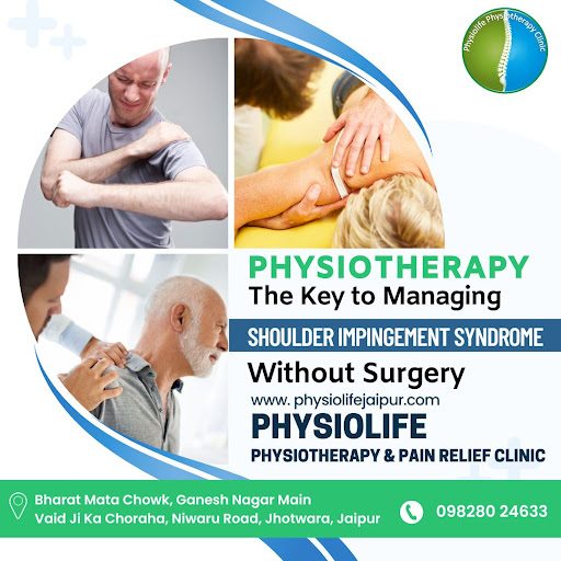 Shoulder impingement syndrome is a common cause of shoulder pain. It occurs when there is impinge… post image