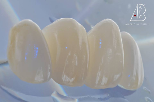 Scuola di Modellazione Dentale Afg - Thumbnail