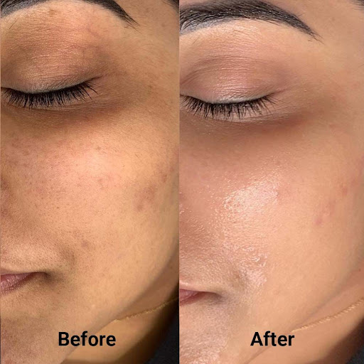 Best Cosmetologist In Mansarovar

#LUMINASKIN&AESTHETICCLINI