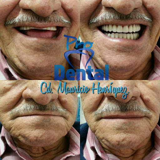 Consultorio dental ProDental San Cristóbal de Las Casas - Thumbnail