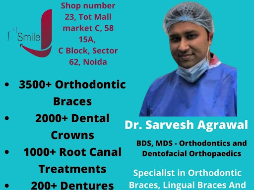 Consultation with Senior Dentist in Noida Sector 62 post image