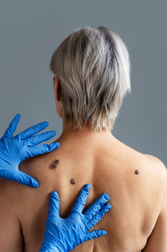 Best Cosmetologist In Mansarovar

#LUMINASKIN&AESTHETICCLINI