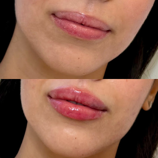 NewSkin MedSpa | Plastic Surgery