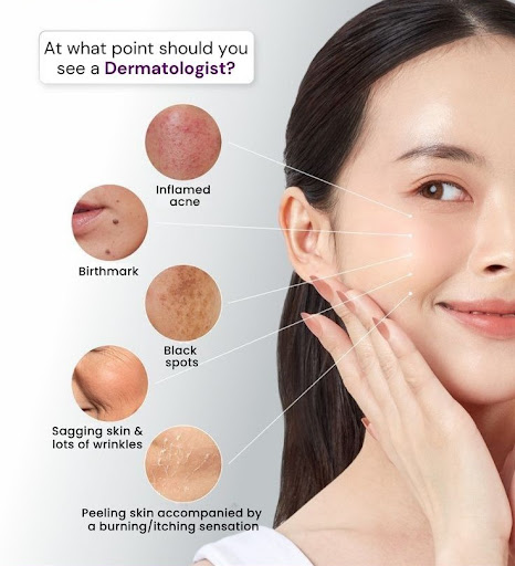 🌿 At what point should you see a Dermatologist? post image