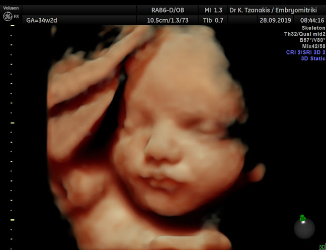 Αντωνιου Μιχελιδάκη 7, Χανιά 731 32