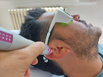 Tatérapi Laser LA ROCHELLE | Réflexologie auriculaire | Arrêt Tabac - Perte de poids - Stress - Douleurs à La Rochelle