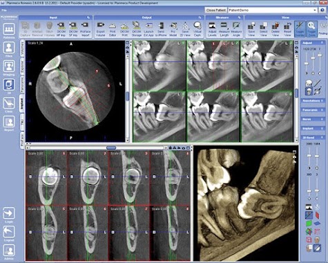 KRANEX CENTRO DE TOMOGRAFIAS ODONTOLOGICAS, Author: KRANEX CENTRO DE TOMOGRAFIAS ODONTOLOGICAS