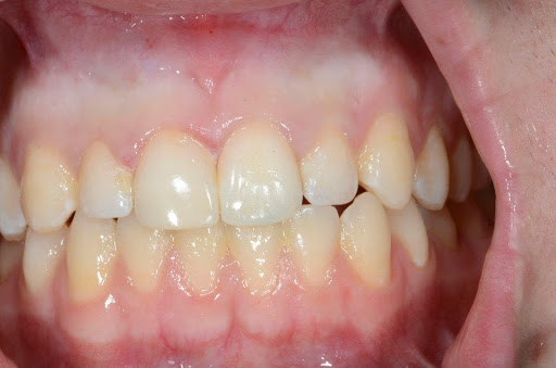 Atencio Dentistry of Reno NV - Thumbnail