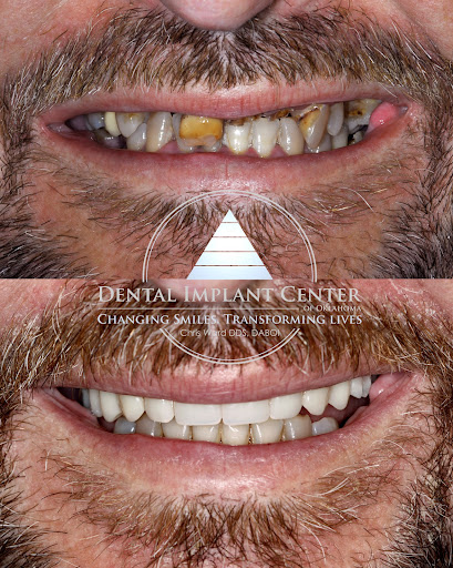 Dental Implant Center of Oklahoma | Chris Ward DDS DABOI
