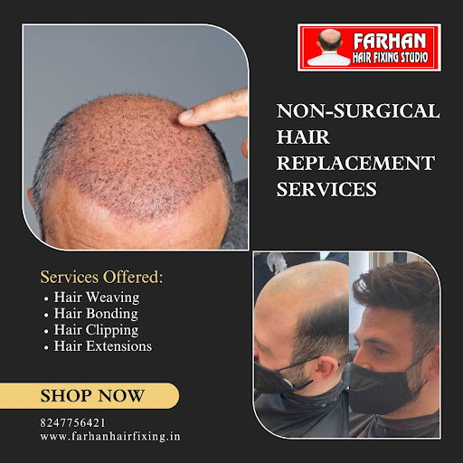 A Comprehensive Overview of Non-Surgical Hair Replacement Services