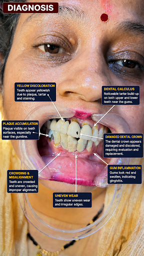 Dental offer post image