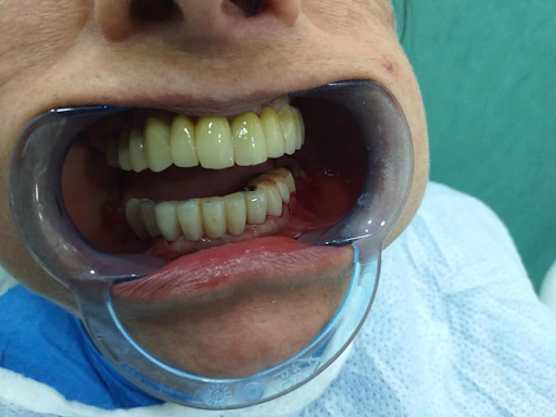 Studio Dentistico Zuccarino dott. Stefano - Thumbnail
