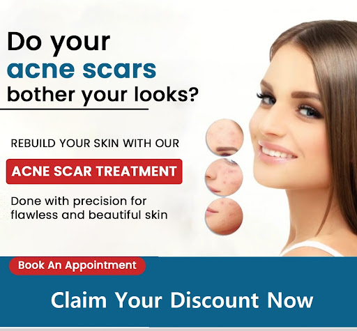 At SKIN CliniC in Delhi NCR, experienced dermatologists and cosmetology specialists offer persona…