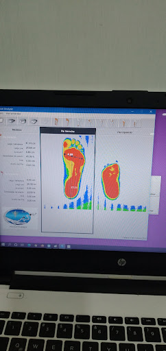 Pro active feet - Thumbnail