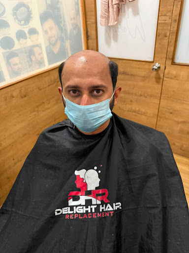 Facing hair loss can take away your self-assurance, but getting your full hair back does not mean… post image