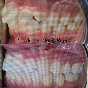 Nevada Dentistry & Braces by null