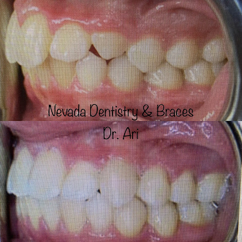 Nevada Dentistry & Braces by null