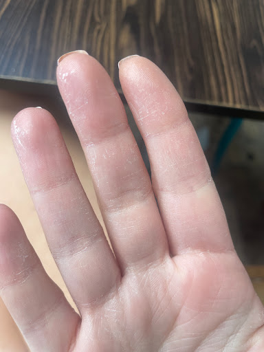 Delicate Nails - Visual