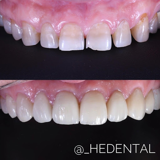 Clínica HEDental Logo