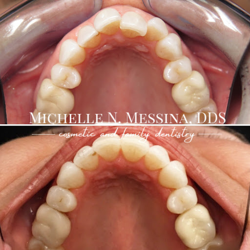 Michelle N. Messina, DDS - Thumbnail