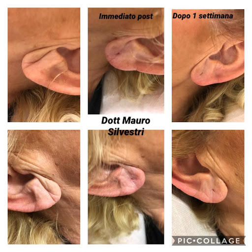 Mauro dott. silvestri medicina estetica - Thumbnail