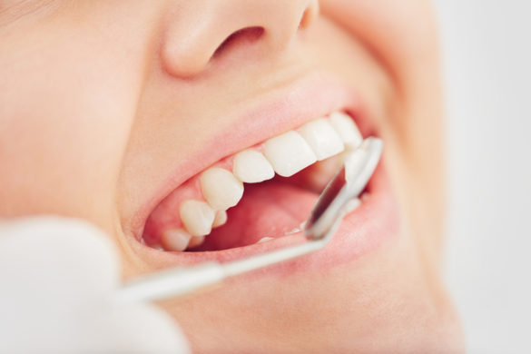 Bridge Dental