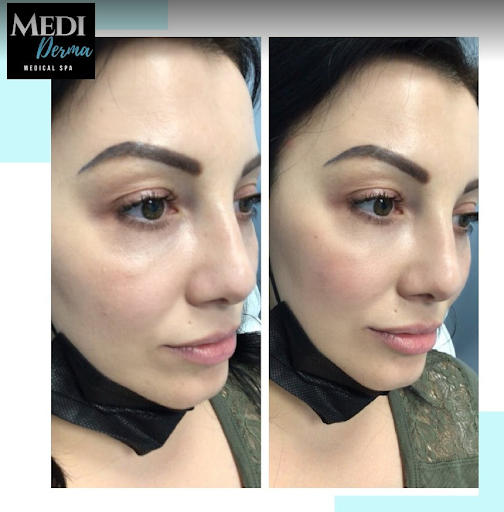MediDerma Medical Spa - Thumbnail