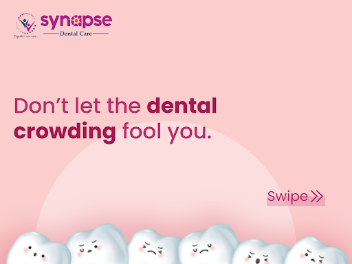 ✔️ Give your teeth the safe space they need. 🦷  post image