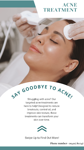 Say Goodbye to Acne 🌸 post image