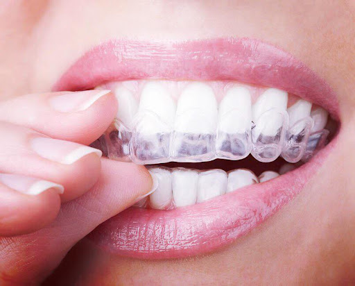 Interdental S.r.l. - Visual