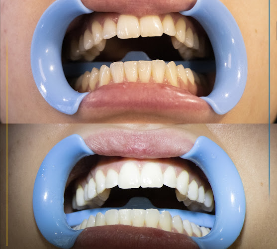 Comentarii opinii despre ΜΑΓΚΑΤΣΑΣ ΓΕΩΡΓΙΟΣ ΟΔΟΝΤΙΑΤΡΟΣ ΠΑΙΔΩΝ & ΕΝΗΛΙΚΩΝ .ΠΡΟΣΘΕΤΙΚΗΣ ΚΑΙ ΕΜΦΥΤΕΥΜΑΤΩΝ.